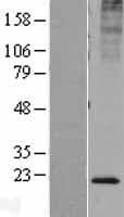 KDELR2 Protein (Over-Expression Lysate Myc-DDK (Flag))