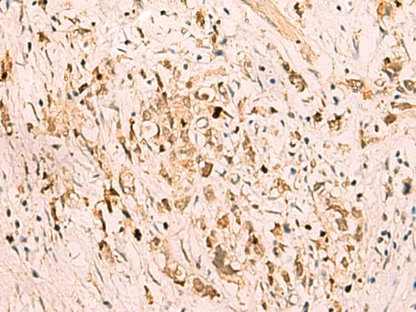 SGTA / SGT Antibody