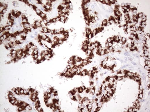 ABAT Antibody (aa29-323, clone UMAB180)