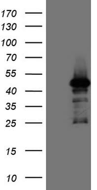 PDIA6 / ERP5 Antibody (clone OTI2H3)