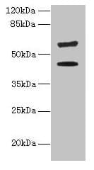 KRT73 / Keratin 73 Antibody