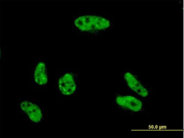 VPS72 Antibody (clone 2G6)