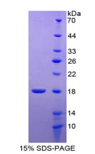 Human HIST2H2BE Protein (Recombinant His-T7)
