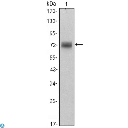 ZBTB16 / PLZF Antibody