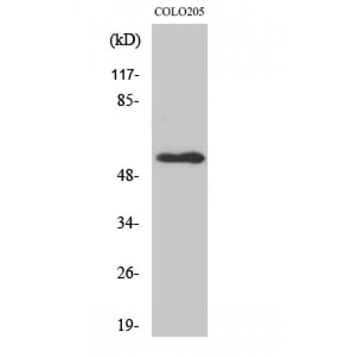 NPY5R Antibody (190-270 aa, Internal)