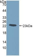 GREM1 / Gremlin-1 Antibody (aa26-184)