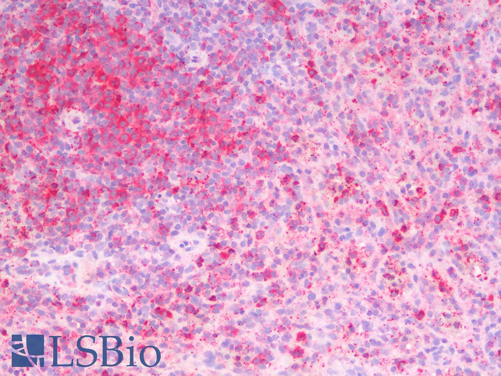 IHC-plus™ MMP2 Antibody
