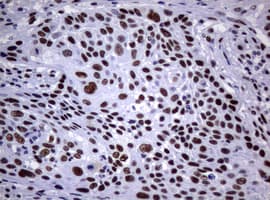 NBN / Nibrin Antibody (clone OTI7D5)