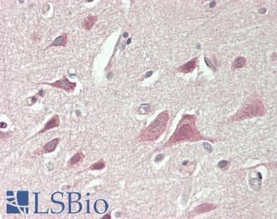 IHC-plus™ RAPH1 Antibody (Internal)