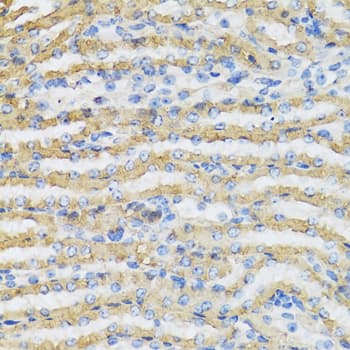 C4BPB / C4BP Beta Antibody