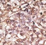 Polyclonal Rabbit anti-Human DKK4 Antibody (aa188-217, IHC, WB)