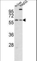 Polyclonal Rabbit anti-Human CRY2 Antibody (aa564-593, IHC, WB)