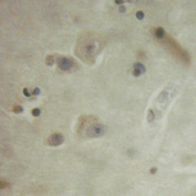 FRS2 Antibody (phospho-Tyr436)