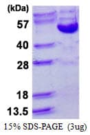 Human CCNB2 / Cyclin B2 Protein (Recombinant His)