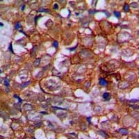 EPHA1 / EPH Receptor A1 Antibody (Internal)