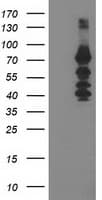KATNB1 Antibody (clone OTI5A10)