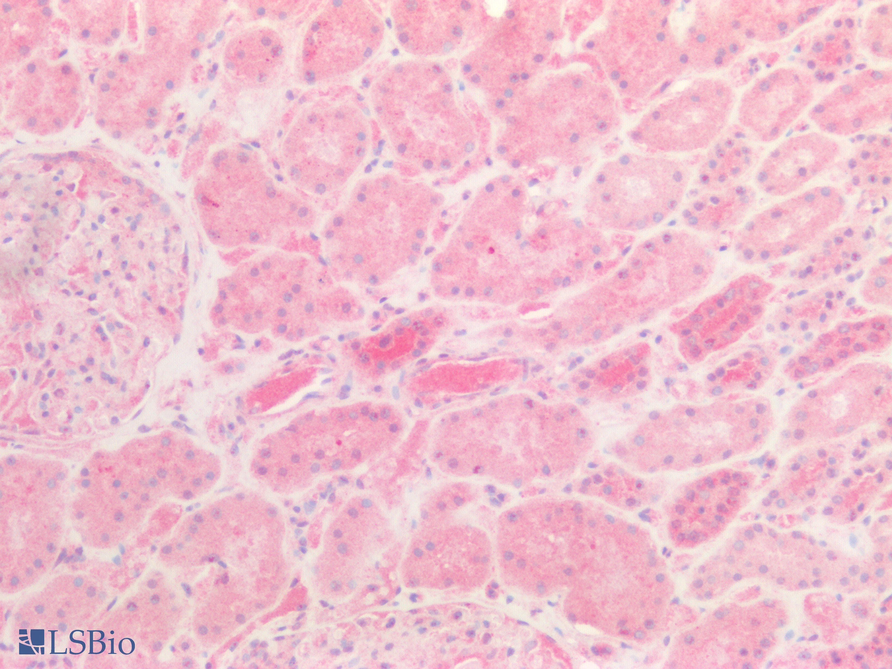 Polyclonal Rabbit anti-Human HABP2 Antibody (aa24-560, IHC, WB)