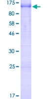 Human MTDH / Metadherin Protein (Recombinant GST)