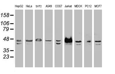 IHC-plus™ SSB / La Antibody (clone 1E11)