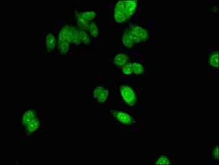Polyclonal Rabbit anti-Human NOLA2 Antibody