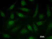 Monoclonal Mouse anti-Human SATB1 Antibody (clone 3548D4_2a, IF, WB)