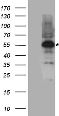Polyclonal Rabbit anti-Human AML1 / RUNX1 Antibody (WB)