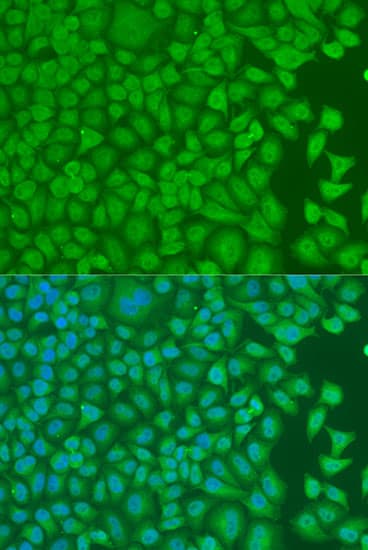 Polyclonal Rabbit anti-Human HnRNP-E1 / PCBP1 Antibody (IHC, IF, WB)