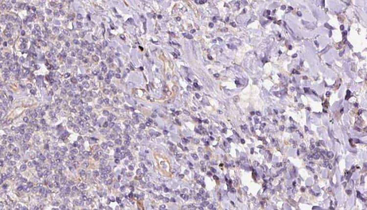 SACM1L / SAC1 Antibody