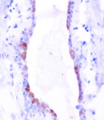 BBOX1 / BBOX Antibody (clone UMAB119, Carrier-free)