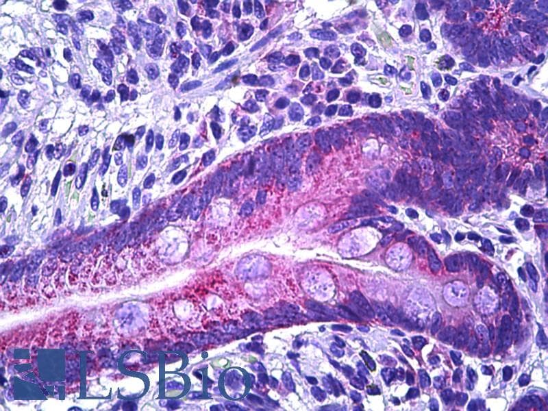 IHC-plus™ IRS1 Antibody (aa289-338)