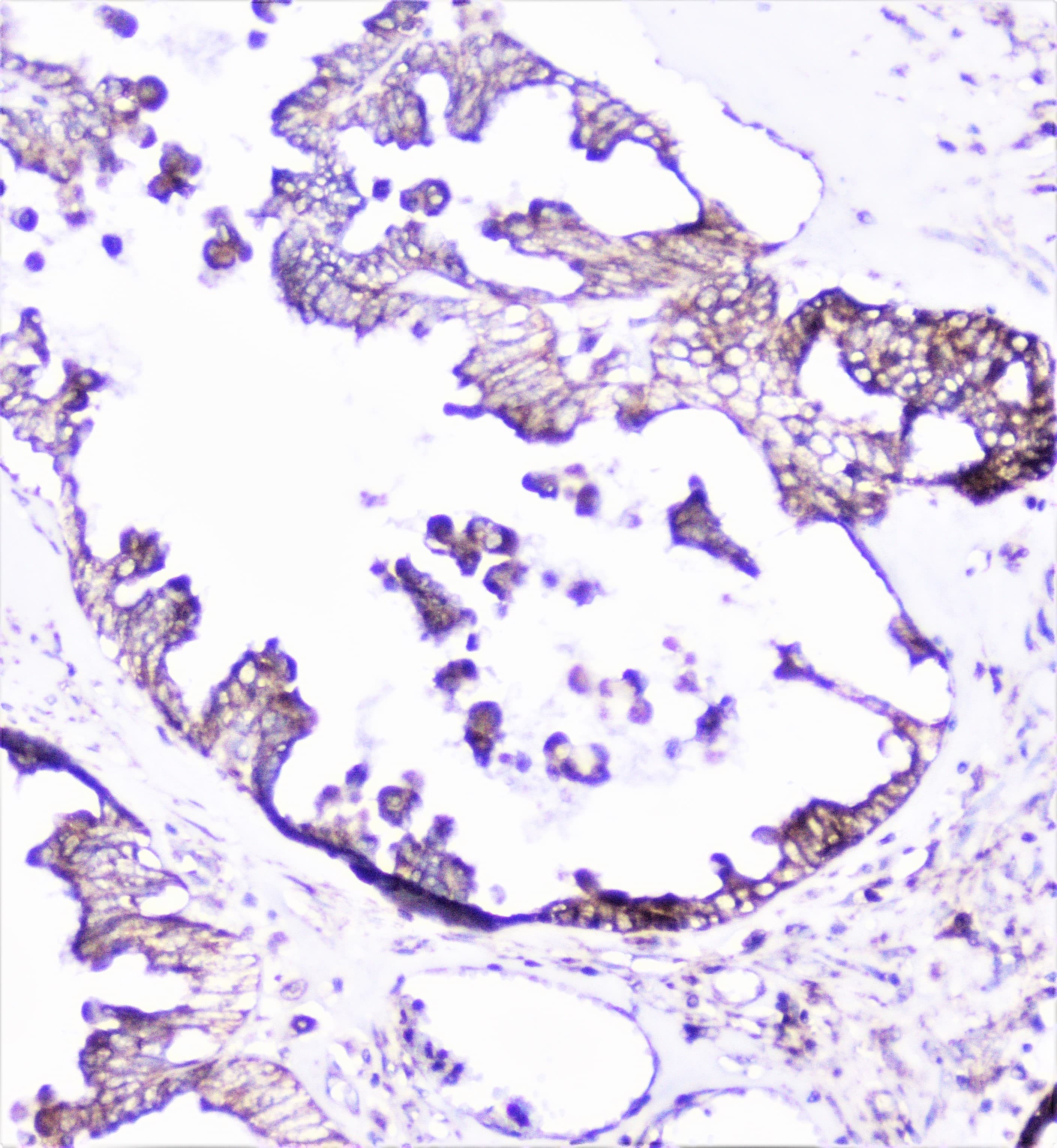 CTTN / Cortactin Antibody