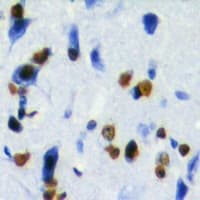 ZBTB48 / HKR3 Antibody