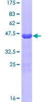 Human THRSP Protein (Recombinant GST)