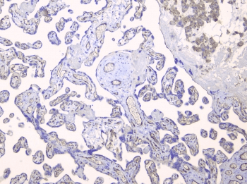 TEK / TIE2 Antibody