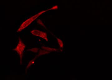 Polyclonal Rabbit anti-Human RPL30 / Ribosomal Protein L30 Antibody (IHC, IF, WB)