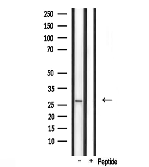 FGF23 Antibody