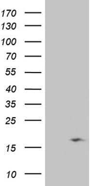 NDUFB3 Antibody (aa2-98, clone OTI2G5)