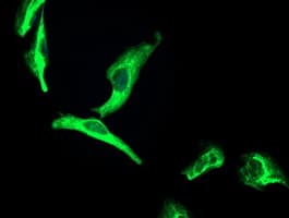 OSGEP Antibody (clone OTI8B3)