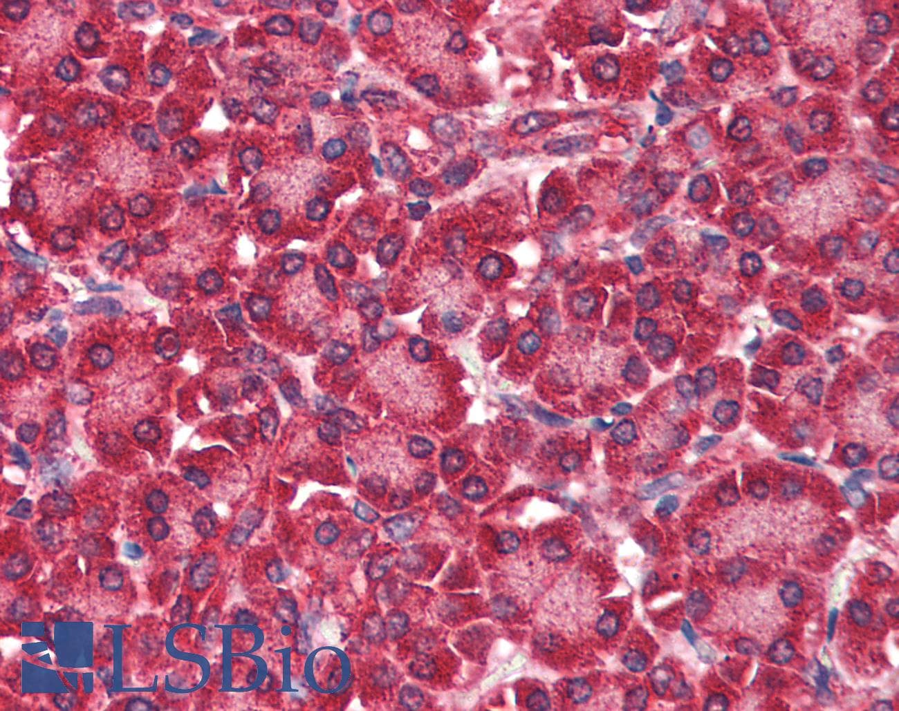 IHC-plus™ EIF4ENIF1 / 4E-T Antibody (aa974-986)