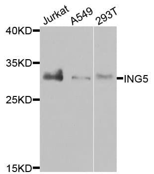 Polyclonal Rabbit anti-Human ING5 Antibody (IHC, IF, WB)
