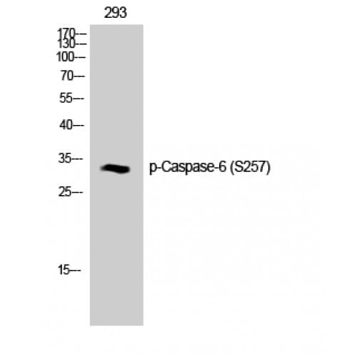 Polyclonal Rabbit anti-Human CASP6 / Caspase 6 Antibody (200-280 aa, IHC, IF, WB)