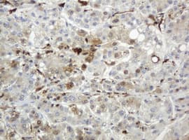 TP / Thymidine Phosphorylase Antibody (clone OTI7B4)
