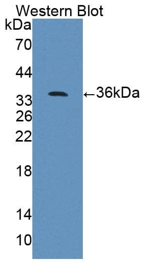 PPFIA1 / LIPRIN Antibody