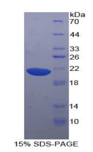 Human HRNR / Hornerin Protein (Recombinant His, N-Terminal)