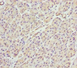 PACSIN2 Antibody