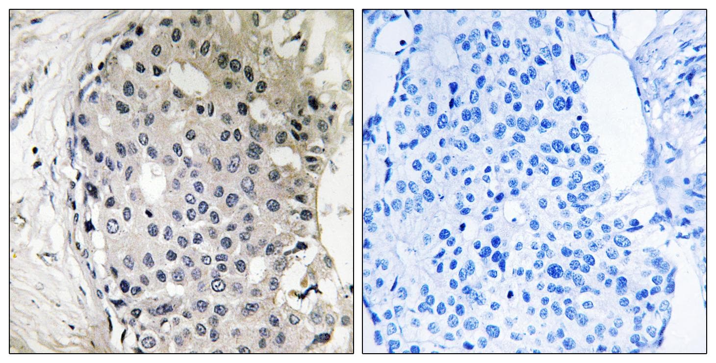 ARHGEF10 / GEF10 Antibody