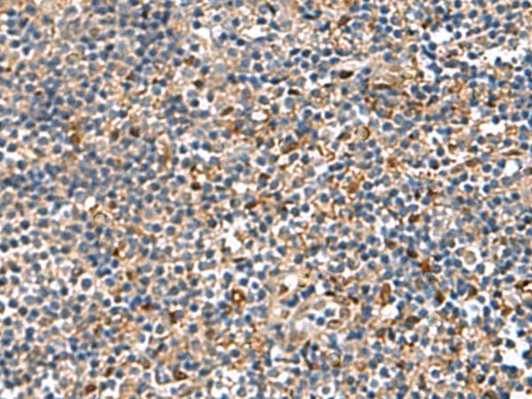 Polyclonal Rabbit anti-Human TGFBI Antibody (IHC, WB)