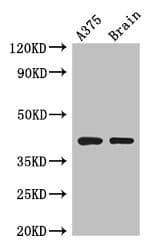 SEPT12 / Septin 12 Antibody