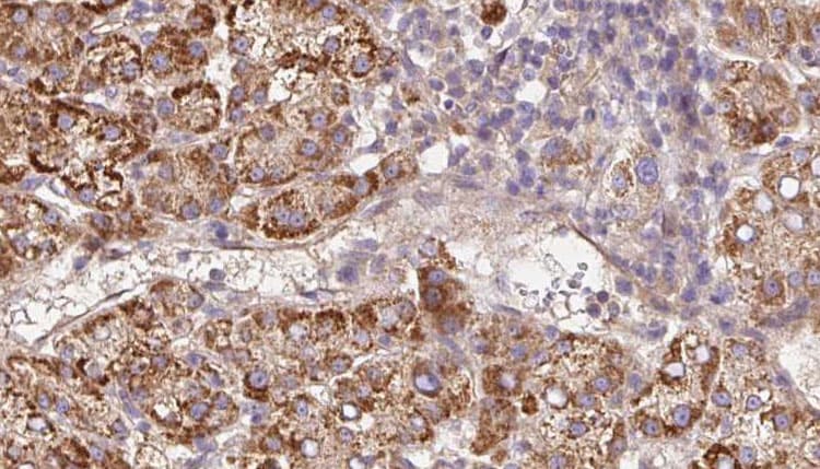 Polyclonal Rabbit anti-Human PLXNA2 / Plexin A2 Antibody (IHC, WB)