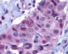 BBC3 / PUMA Antibody